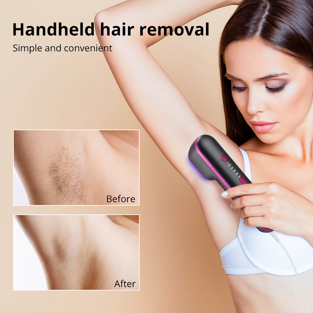 laser hair removal (2)