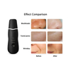 Rechargeable Beauty Equipment Ultrasonic Blackhead Remover Facial Cleaner Skin Scrubber