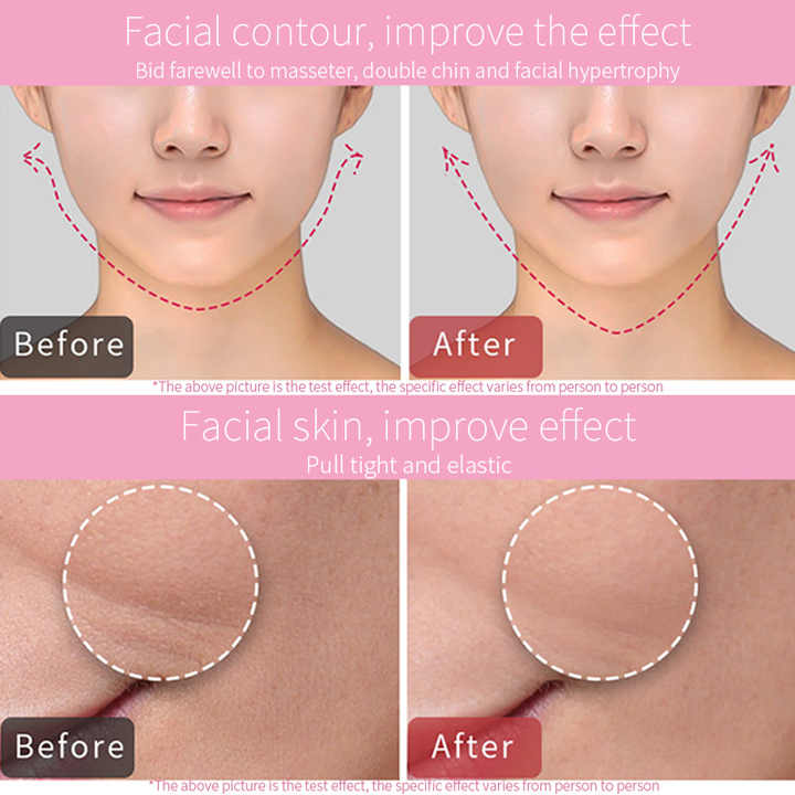 Home Use Beauty Machine V Shape Facial Massage Device